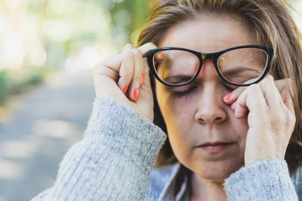 Simple Home Techniques to Manage Itchy Eyes from Hay-Fever: Sydney Eye Clinic