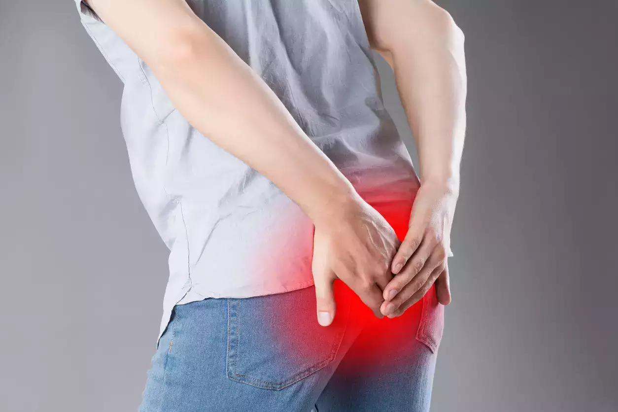 Can Medical cannabis Help with Haemorrhoid Symptoms?